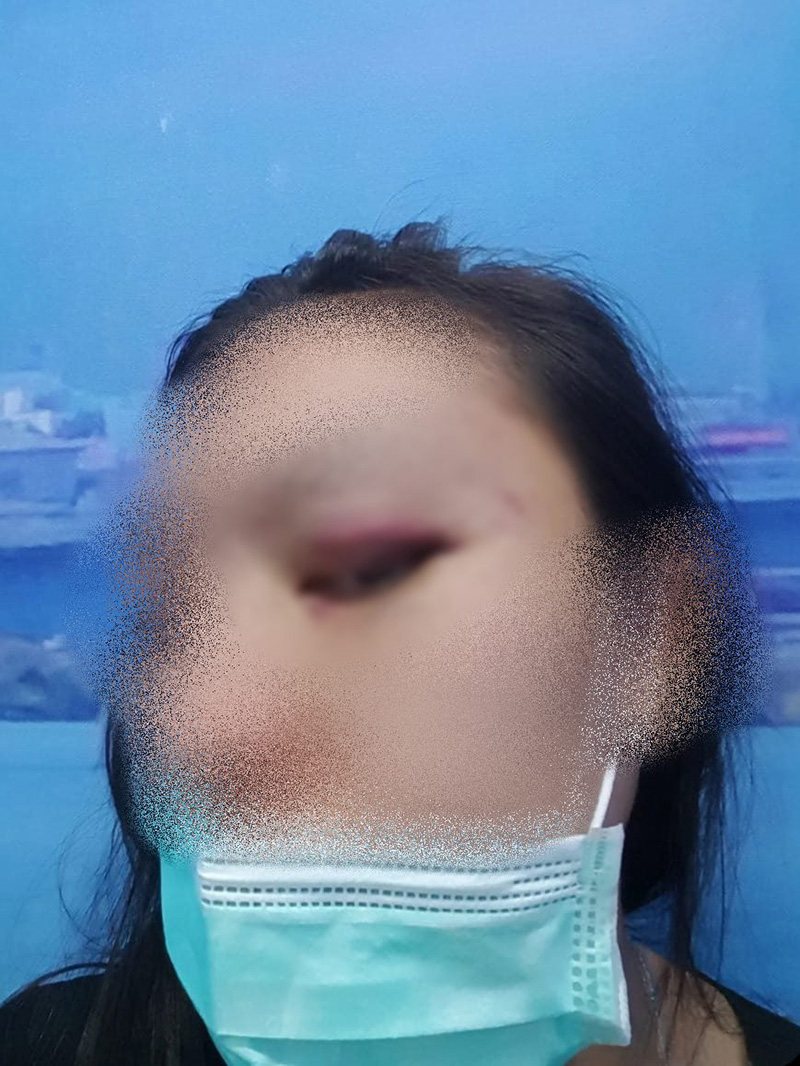 เมียหลวงถูกทำร้าย