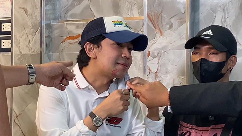 ออกหมายจับ 3 คน แก๊ง UFABET หลัง เก่ง เมธัส ร้องถูกลวงซ้อม-ทวงหนี้โหด !