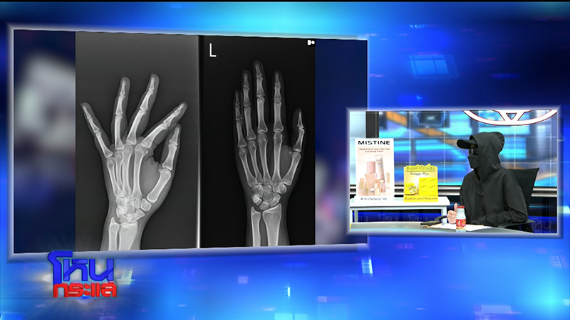 สาวโดนผัวเพื่อนกระทืบ เดือดส่งงานเอน