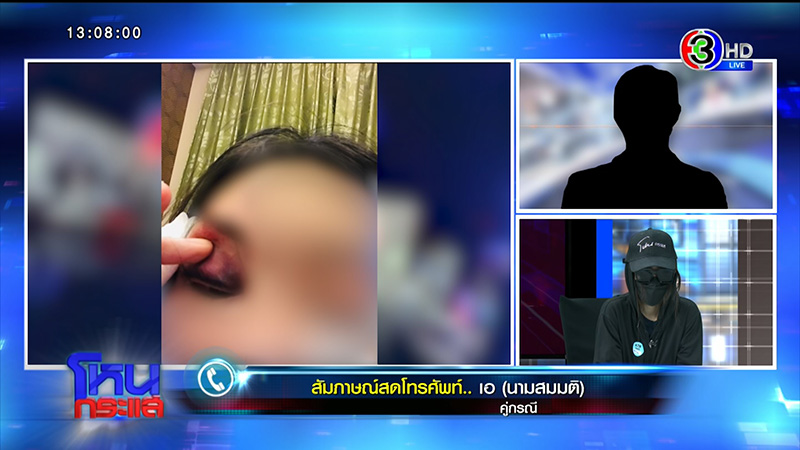 สาวโดนกัดหน้า VS แฟนเก่า