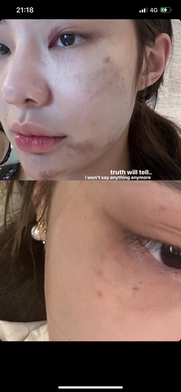 เพื่อนเปิดแชต จีจี้ สุพิชชา ส่งรูปตอนถูก นตท ทำร้ายน่วม