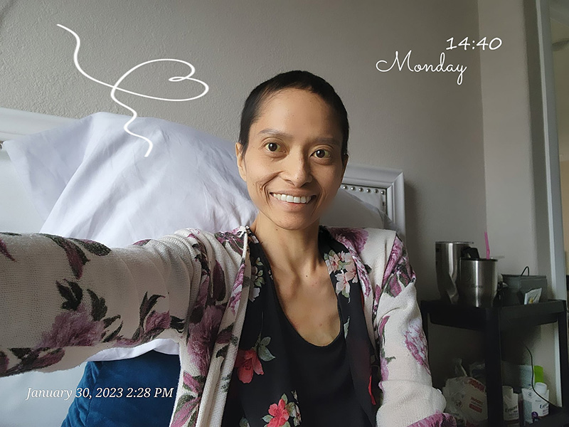 สาวสู้มะเร็งระยะสุดท้าย เผยตับหยุดทำงานแล้ว