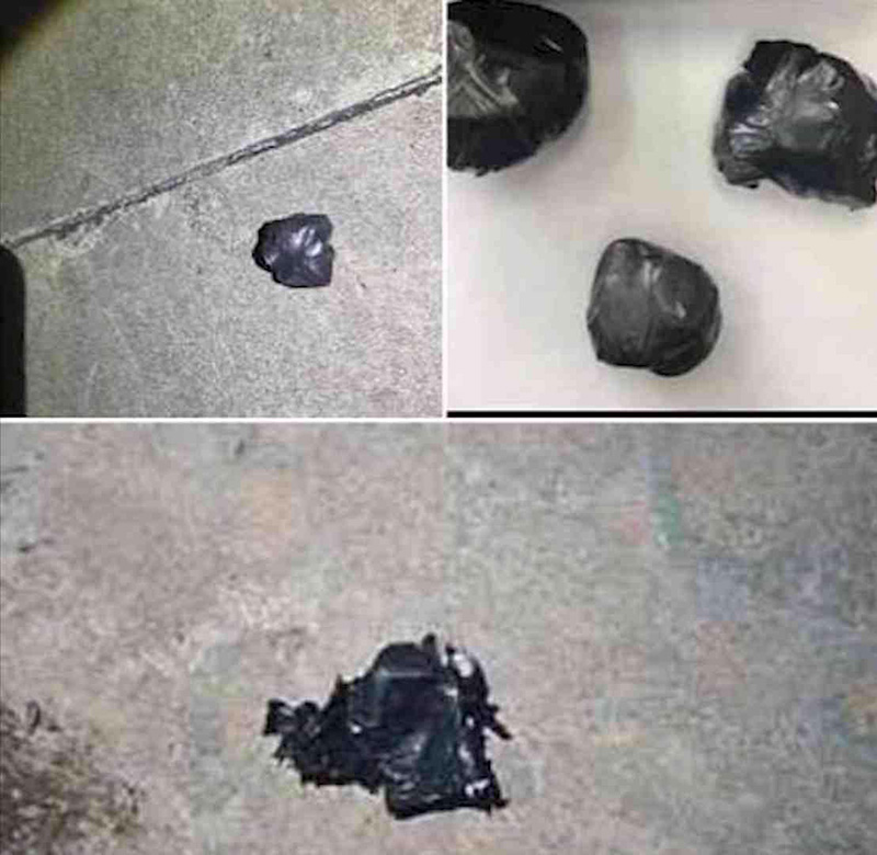 สยอง เด็ก ม 2 เจอระเบิดในโรงเรียน หวังดีจะเอาไปให้ผู้ใหญ่ พลาดบึ้มใส่มือหวิดขาด 