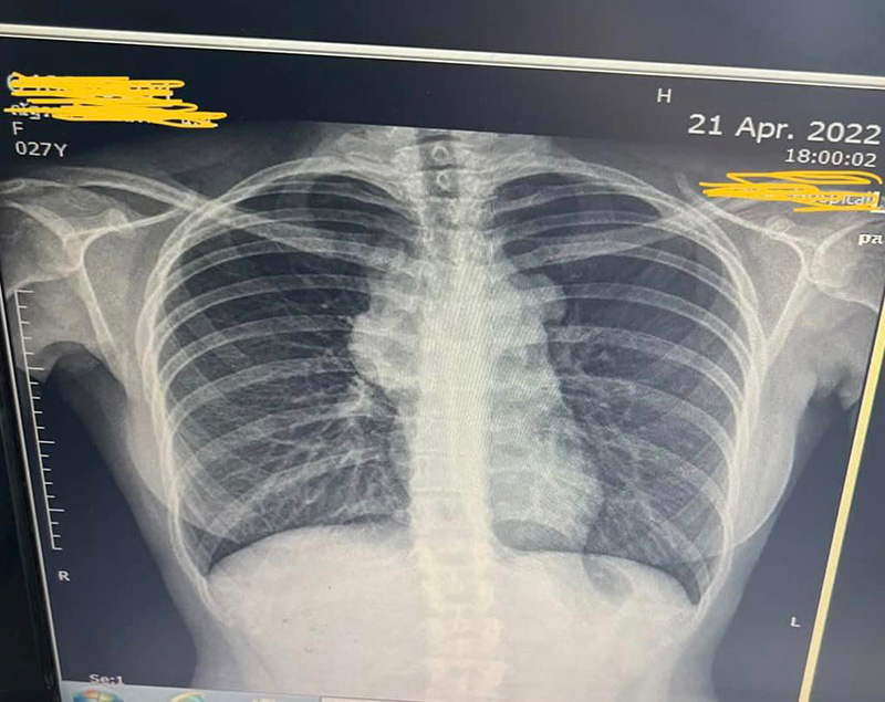 หมอถอดบทเรียน วันที่มาเป็นคนไข้ สู้มะเร็งในวัย 27 ปี