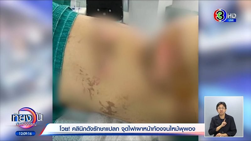 เน็ตไอดอลแฉคลินิกดัง