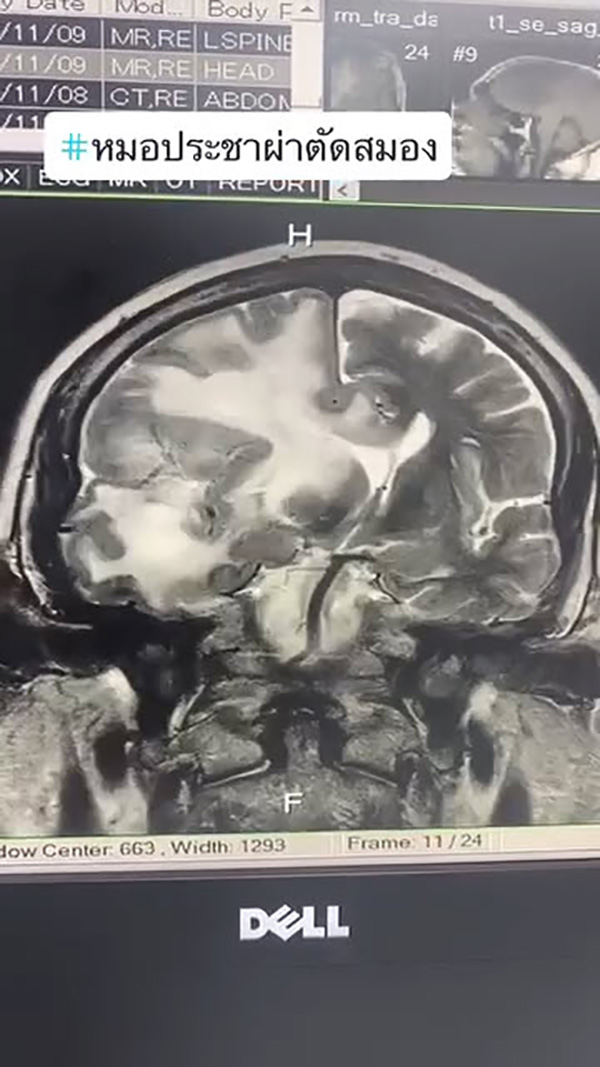 หัวสมอง