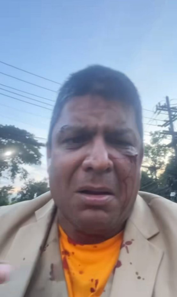 เค ร้อยล้าน 