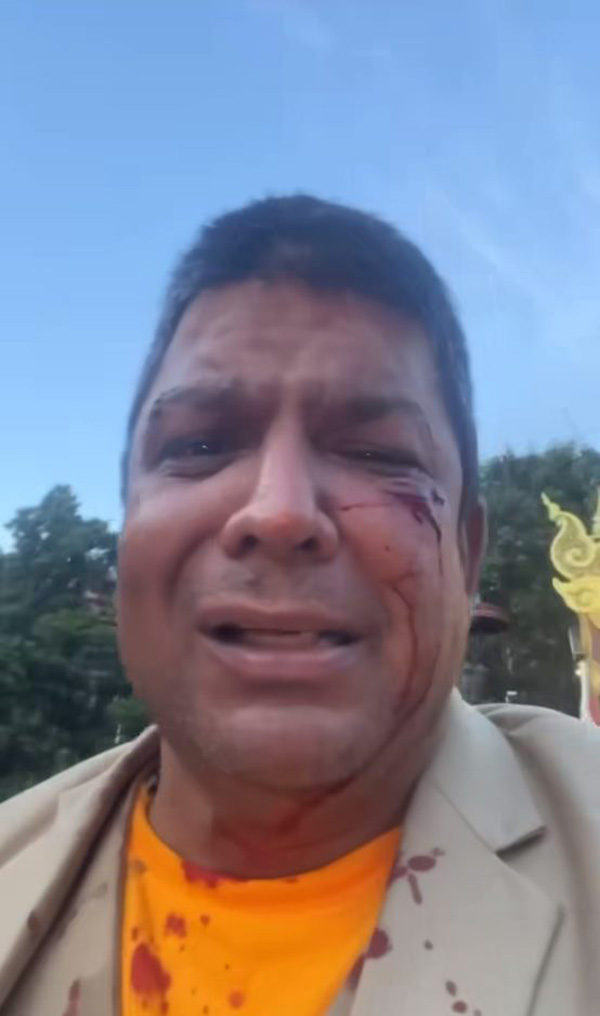 เค ร้อยล้าน 