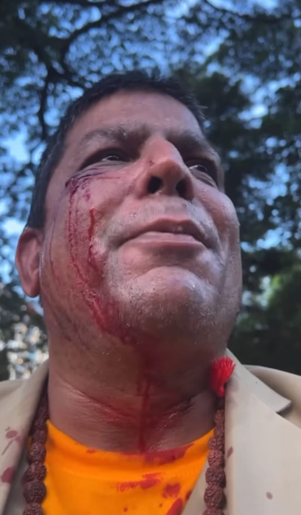 เค ร้อยล้าน 