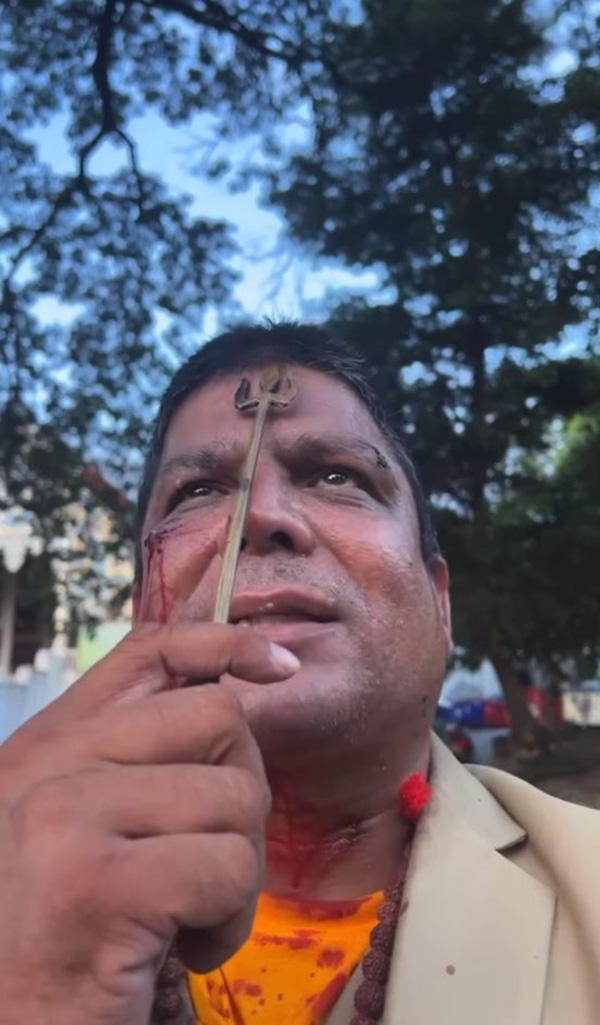 เค ร้อยล้าน 