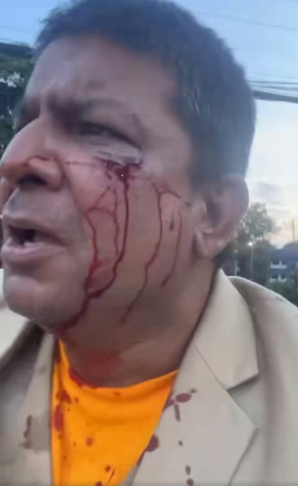 เค ร้อยล้าน 