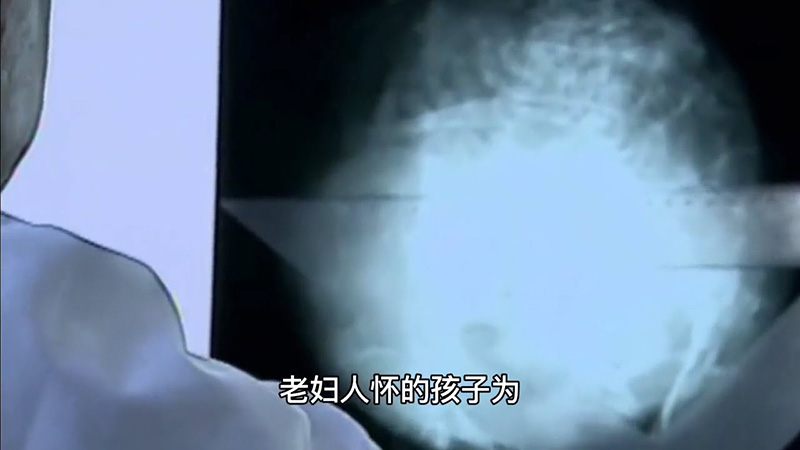 หญิงวัย 91 เข้า รพ หลังหกล้ม หมออึ้งพบมีเด็กในท้อง ลูกร่ำไห้เมื่อฟังความลับแม่ 