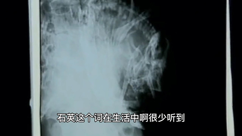 หญิงวัย 91 เข้า รพ หลังหกล้ม หมออึ้งพบมีเด็กในท้อง ลูกร่ำไห้เมื่อฟังความลับแม่ 