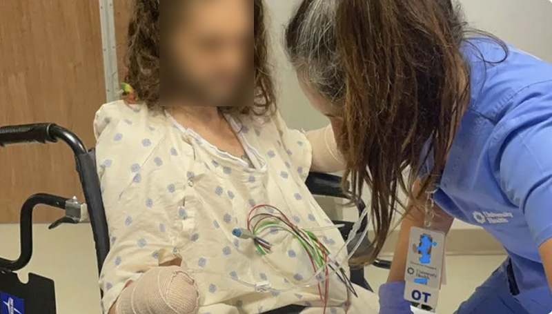 หนุ่มวัย 33 ถูกหมัดกัดติดเชื้อหนัก ต้องตัดมือสองข้างและเท้าเพื่อรักษาชีวิต