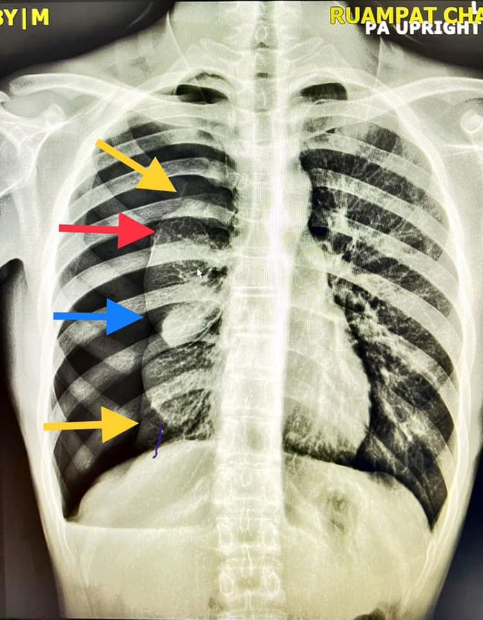 คอมเมนต์