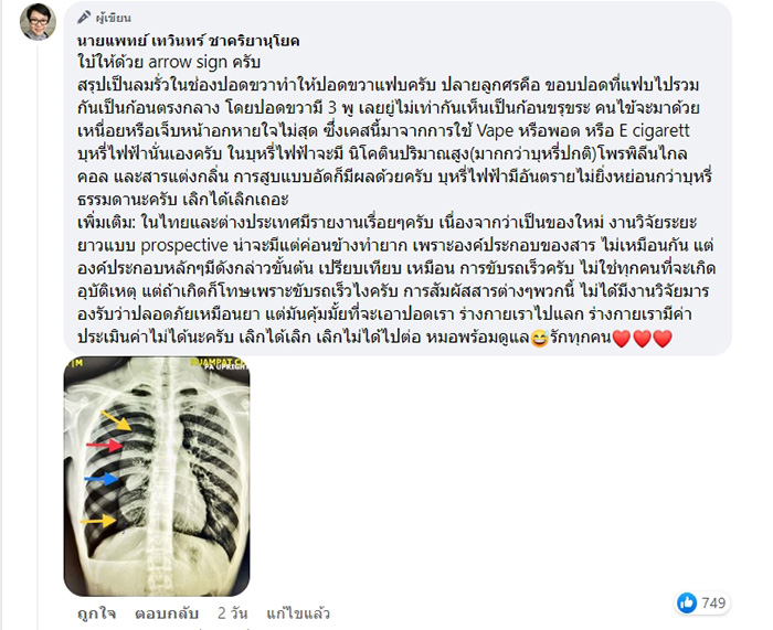 คอมเมนต์