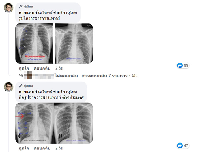 คอมเมนต์