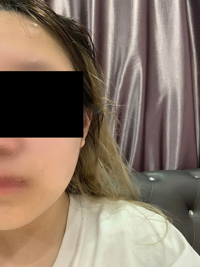 ลูกช้ำ ถูกพ่อเป็น ตร ทำร้าย แม่จับขัง