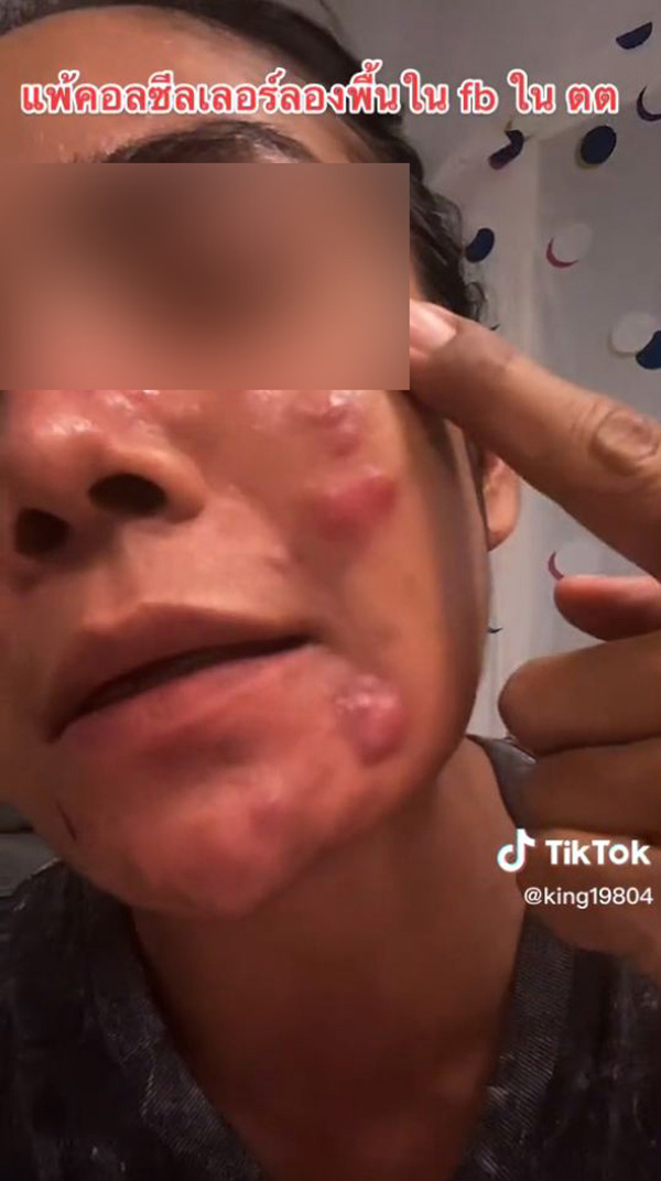 อุทาหรณ์ ซื้อรองพื้นจิ้มจุ่มในเฟซบุ๊ก