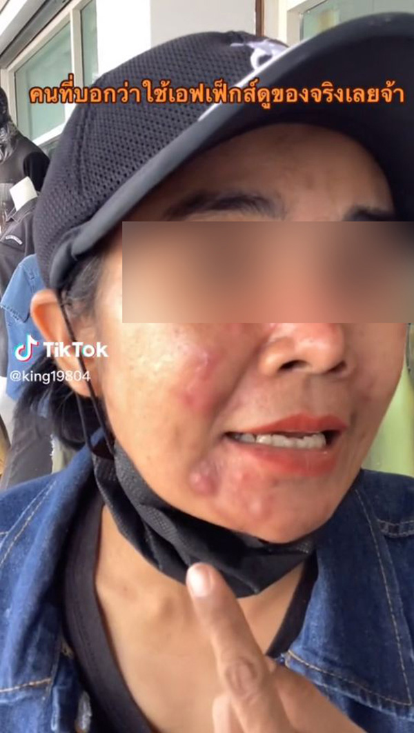 อุทาหรณ์ ซื้อรองพื้นจิ้มจุ่มในเฟซบุ๊ก