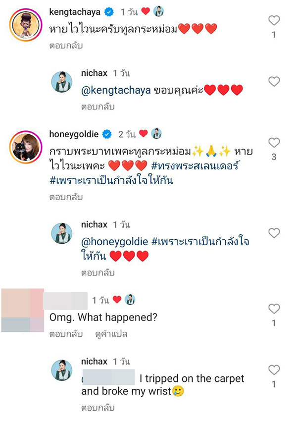 ทูลกระหม่อมฯ ทรงโพสต์ ข้อพระกรหัก เล่นคอนเสิร์ตไม่ได้ 