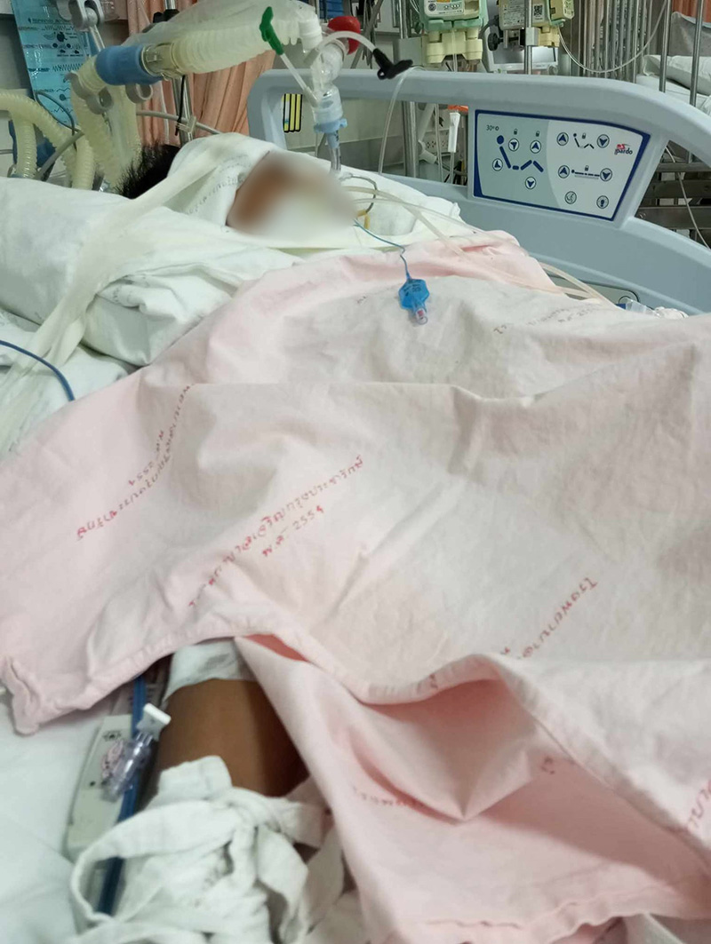 เด็กถูกงูเขียวหางไหม้ฉกลิ้น