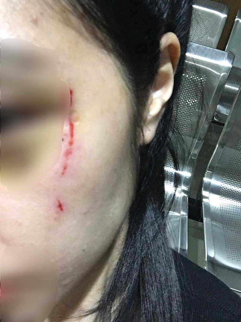 สาวถูกพนักงานโรงแรมดังตบหน้า