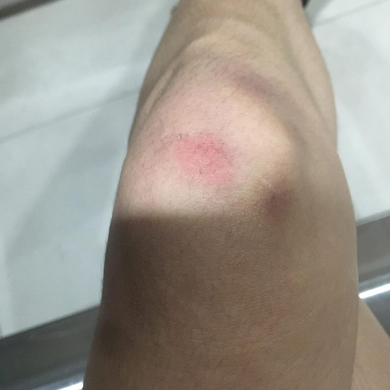 สาวถูกพนักงานโรงแรมดังตบหน้า