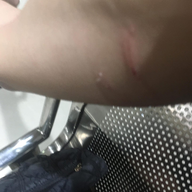 สาวถูกพนักงานโรงแรมดังตบหน้า