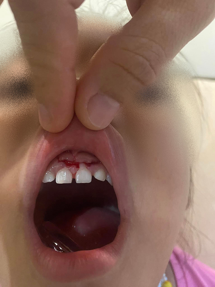  ตั๊ก กรกนก แม่ค้าออนไลน์ แฉ โรงเรียนนานาชาติค่าเทอมเกือบล้าน ลูกล้มเหงือกฉีก