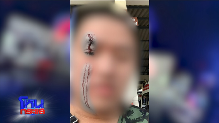 สิบเอกร่ำไห้ จับได้เมียมีชู้