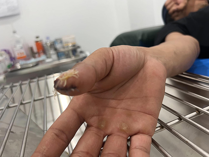 ใบเลื่อยเครื่องเจียรตัดเข้านิ้ว