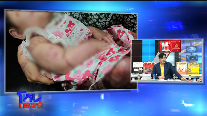 เมียเก่าใจโหด บุกสาดน้ำกรดสาวมอญ ลูก