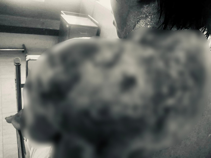 สาวเสียโฉมทั้งร่าง 