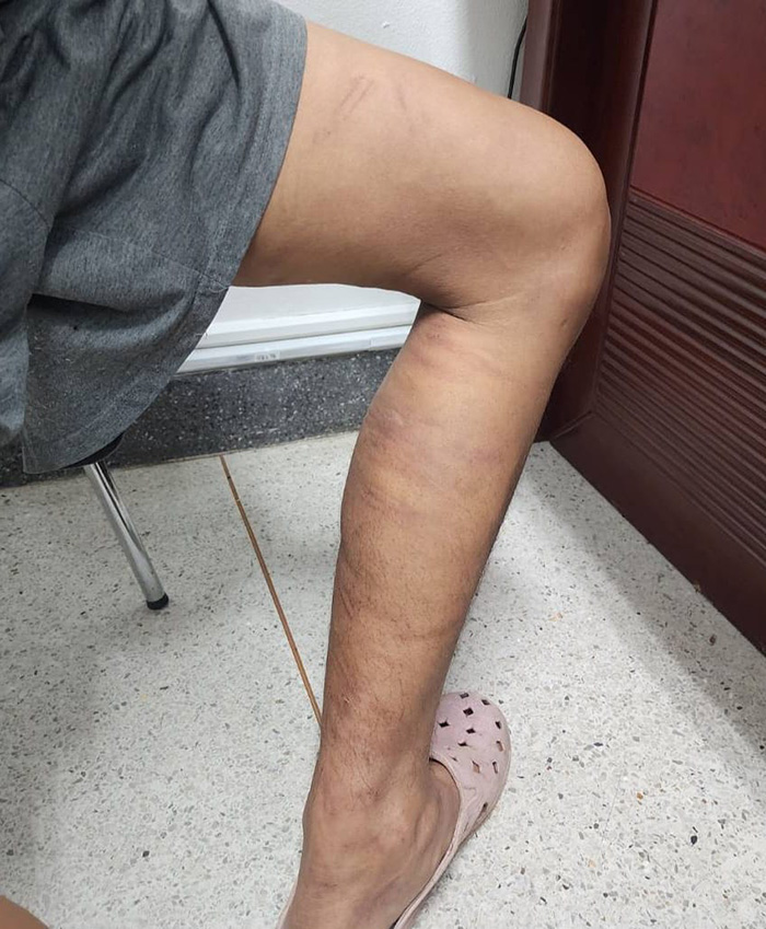 ลูกจ้างหนีตาย