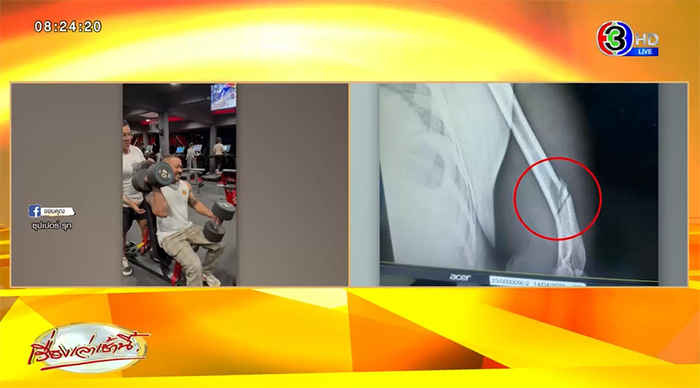 เทรนเนอร์ยกดัมเบล