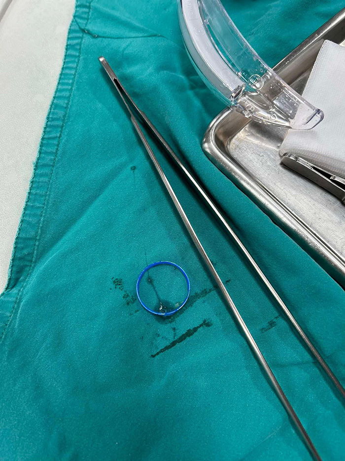 ดื่มน้ำจากขวด ฝาหลุดเข้าคอไม่ทันตั้งตัว