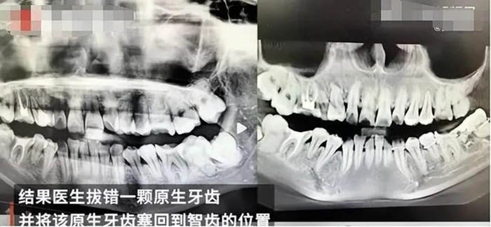 หญิงตกตึกโรงพยาบาลชั้น 11 คลิปสุดท้ายร้อง
