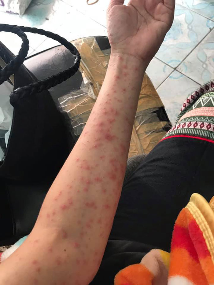 ภูมิคุ้มกันเป็นพิษ