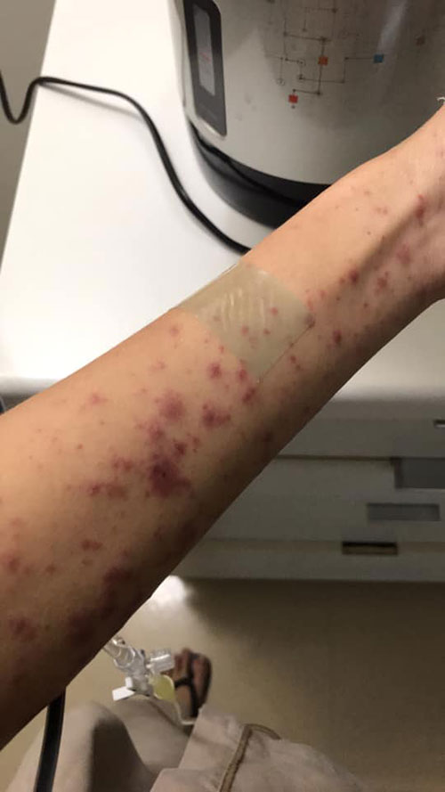 ภูมิคุ้มกันเป็นพิษ