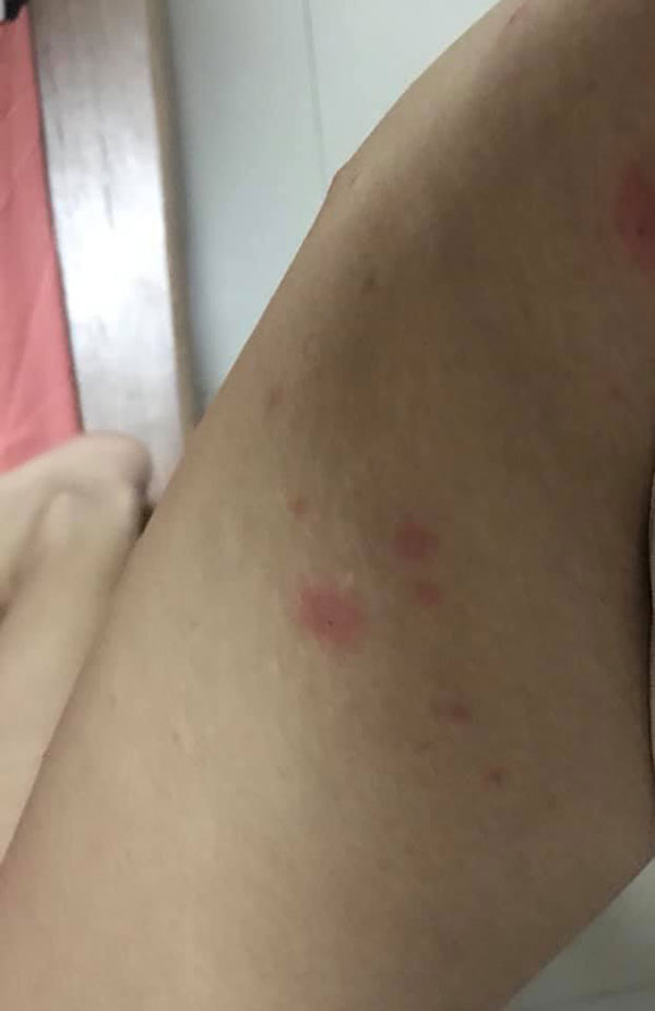 ภูมิคุ้มกันเป็นพิษ