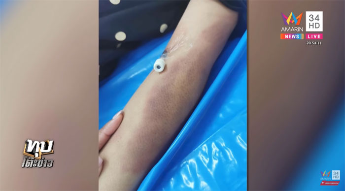 โต้กลับ ไอ้เทพ