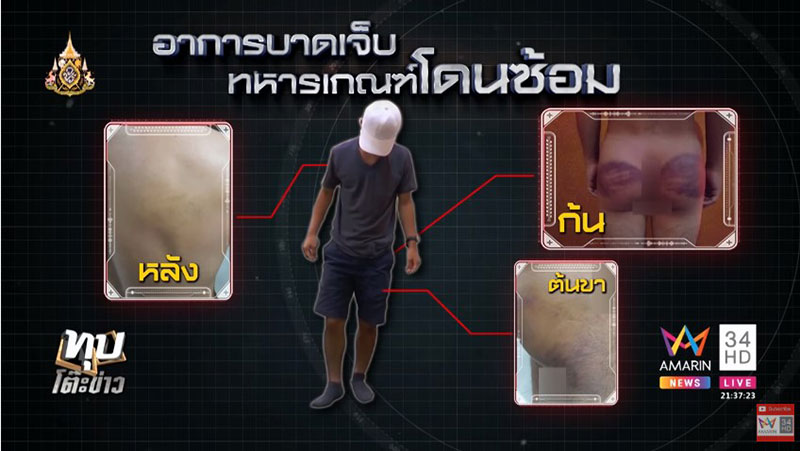 ทหารเกณฑ์