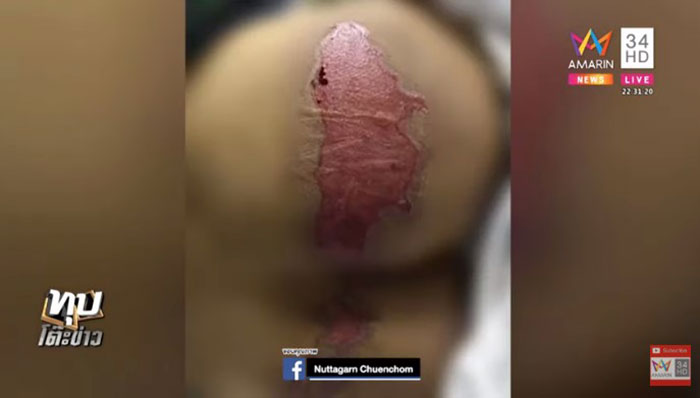 หมอรามาฯ