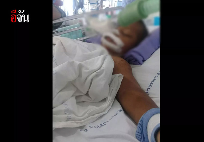 น้องดิว