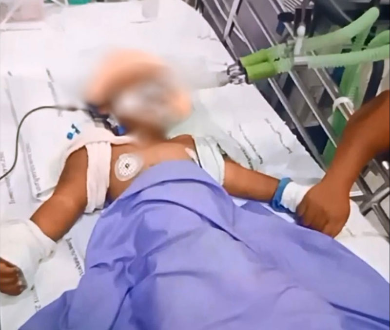 น้องดิว