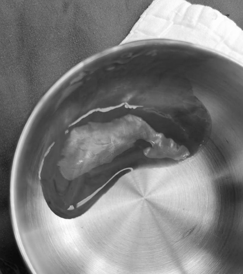 เข่ากระแทกพื้น