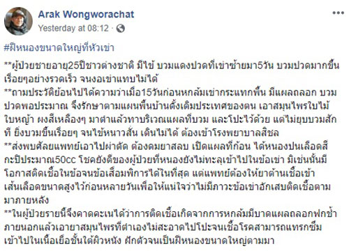 เข่าบวมมีหนอง 