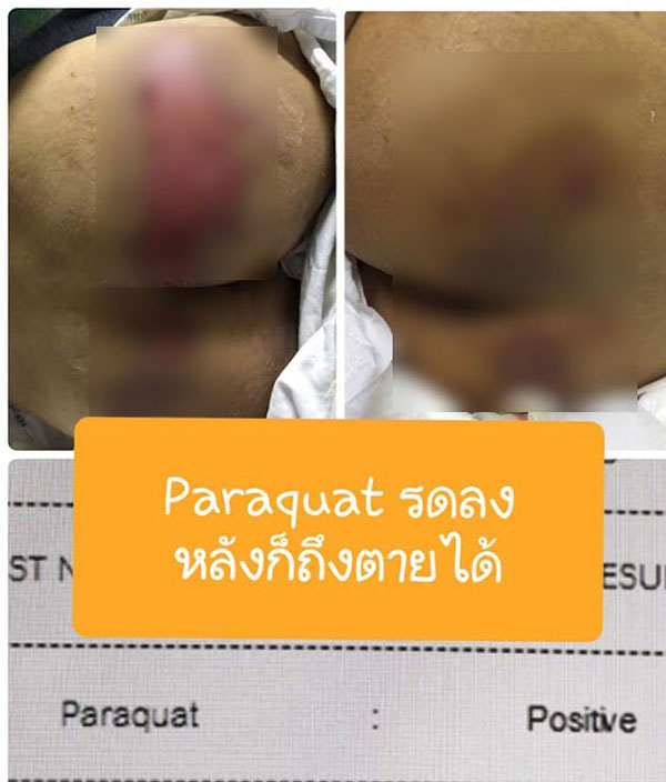 หมอรามาฯ