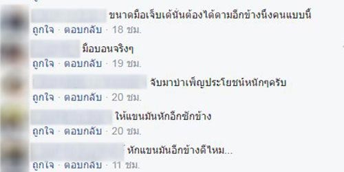 ชายมือบอน